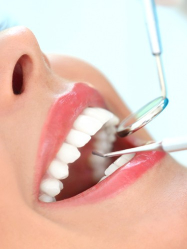 Лечение периодонтита
