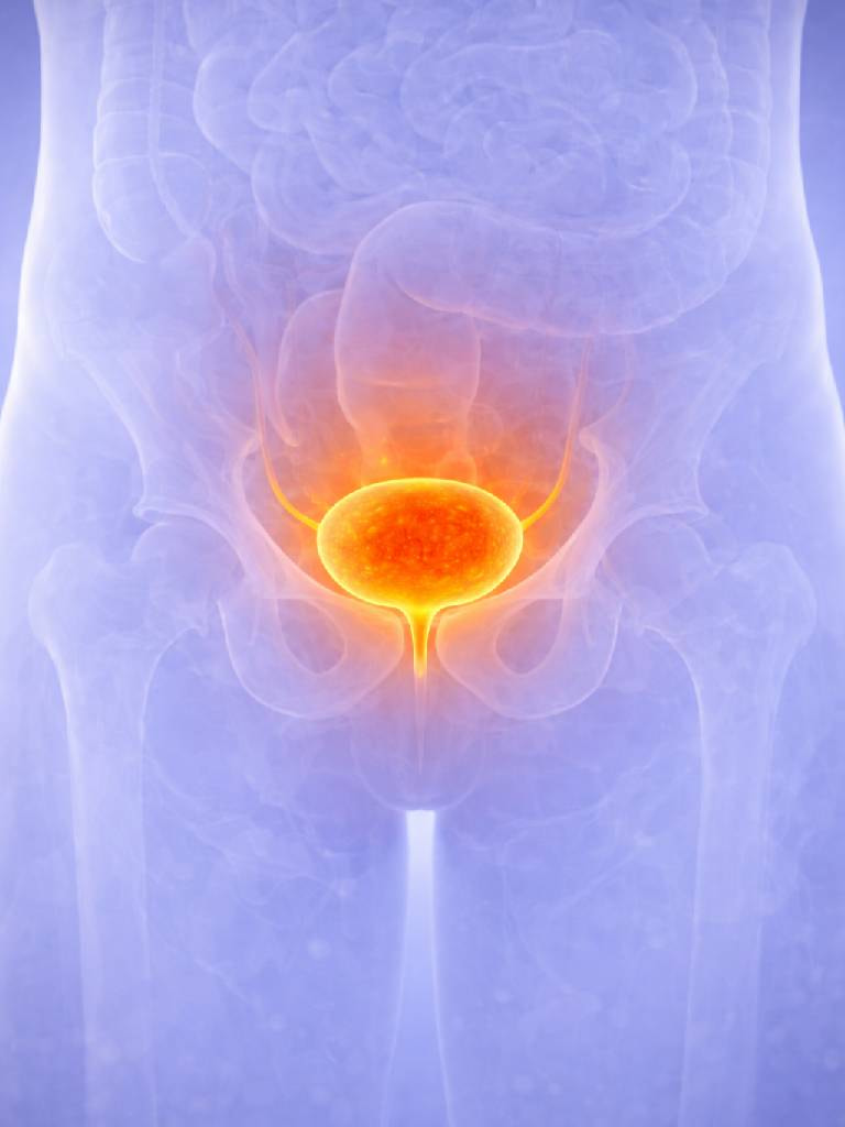 УЗИ предстательной железы