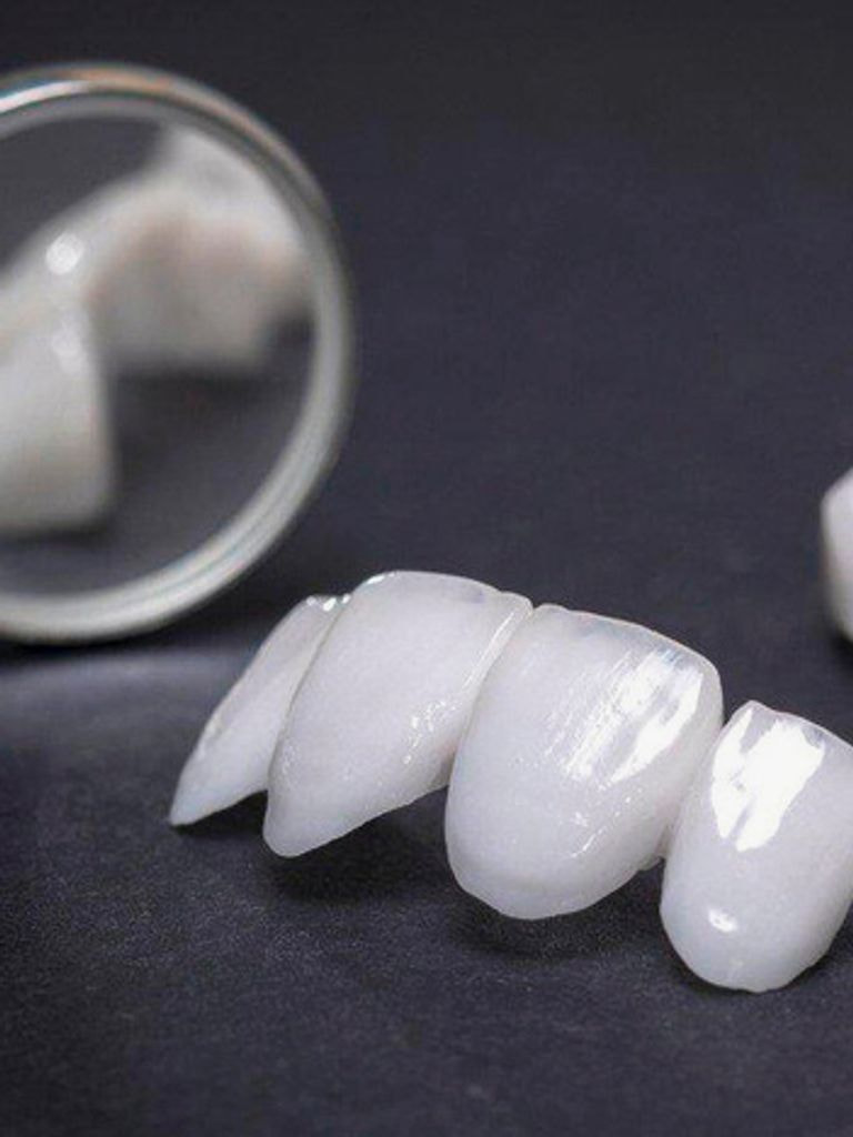 Установка коронки