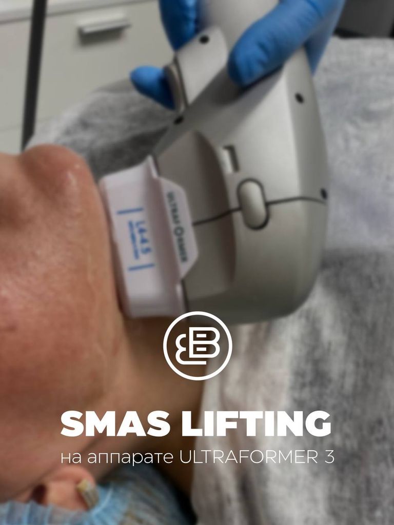 SMAS-лифтинг на аппарате Ultraformer 3
