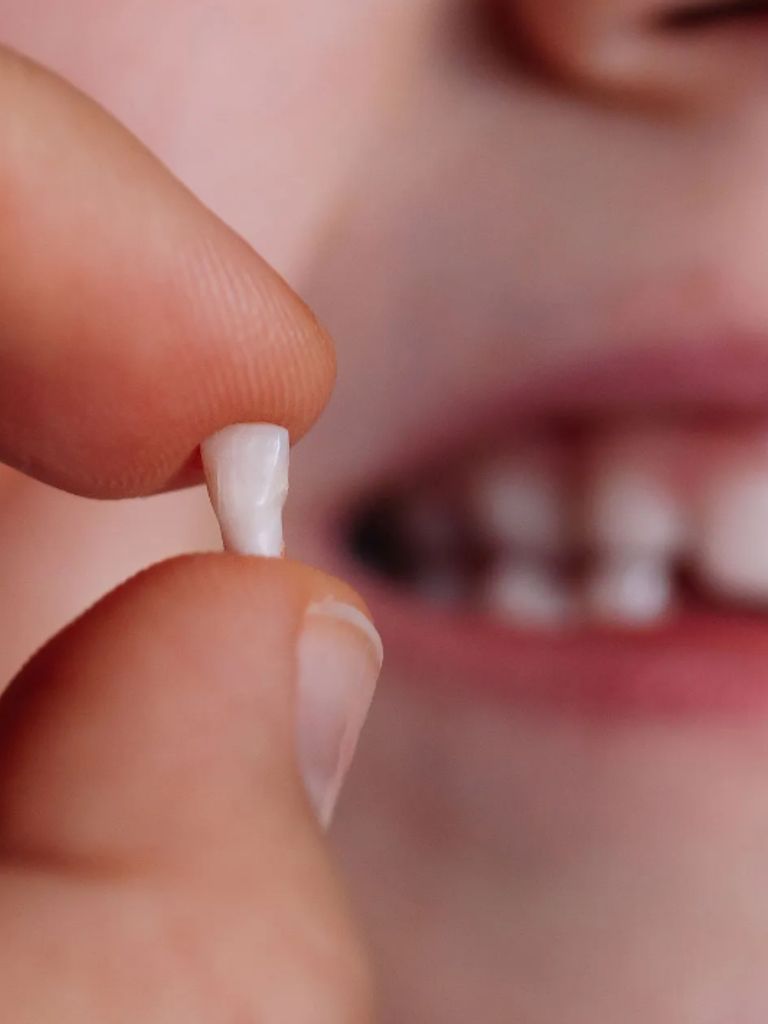 Удаление молочного зуба