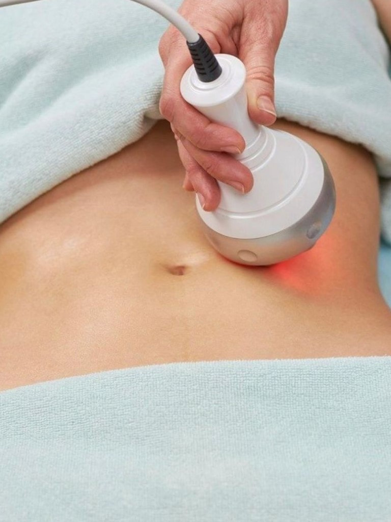 Вакуумный массаж тела, 30 мин.