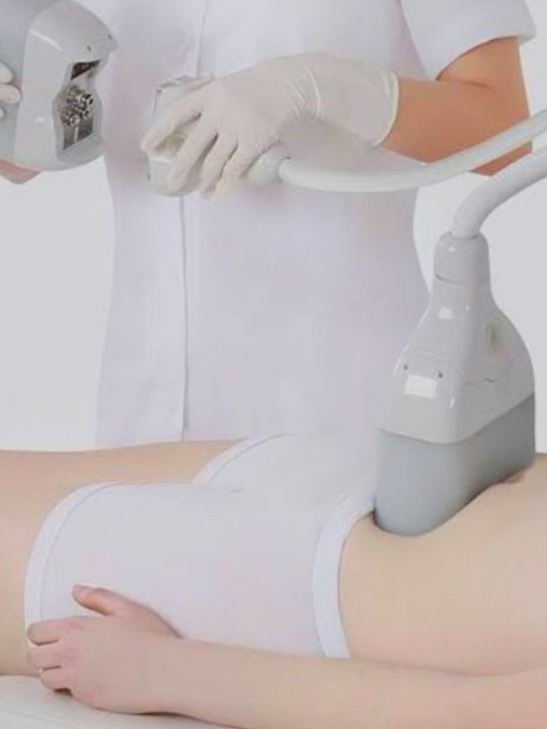 Криолиполиз Premium на аппарате «Clatuu»