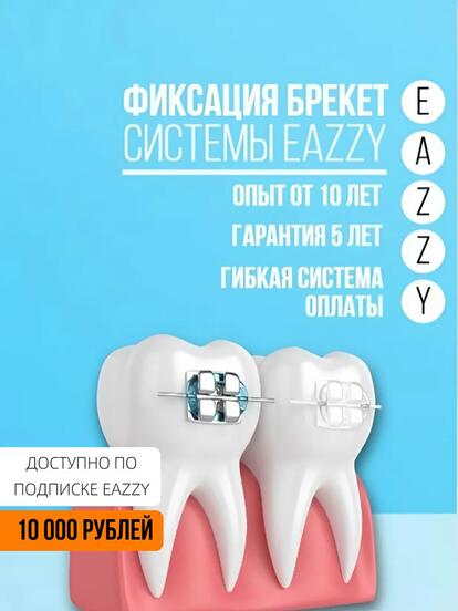 Фиксация брекет системы: EAZZY брекеты