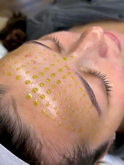 Пилинг лица BioRePeelCl3 (Италия) + Premium SPA-уход губ