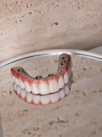 Протез на 1 челюсть